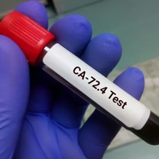 CA-72.4 GASTRIC CANCER MARKER Test